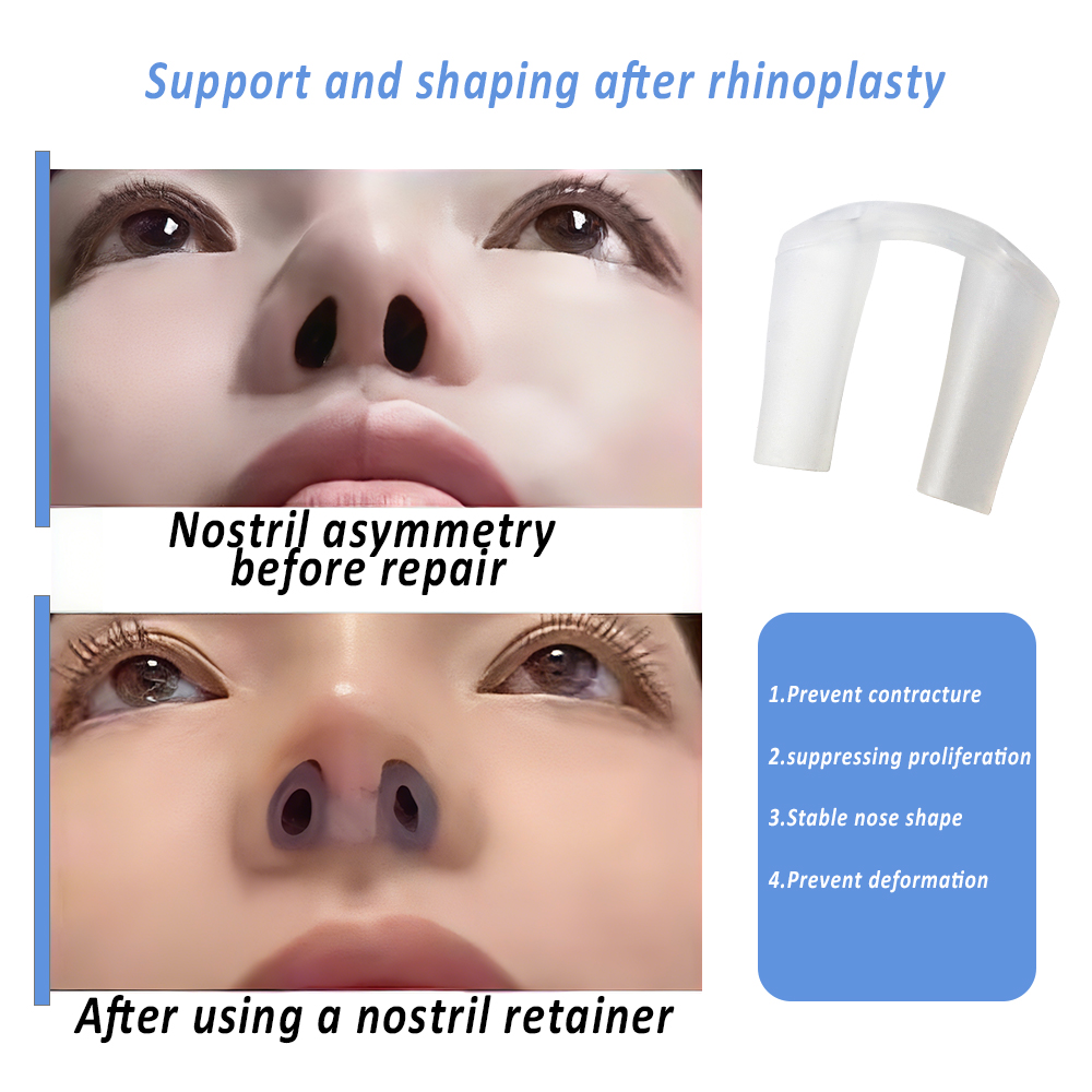 Nostril Retainer for Rhinoplas - đánh giá và giá Anti Snore Contour Pillow